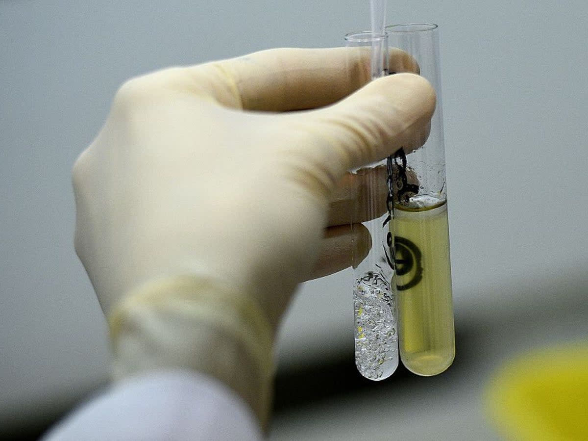 A urine sample at France’s national anti-doping lab near Paris, 2015 (Franck Fife/AFP via Getty Images)