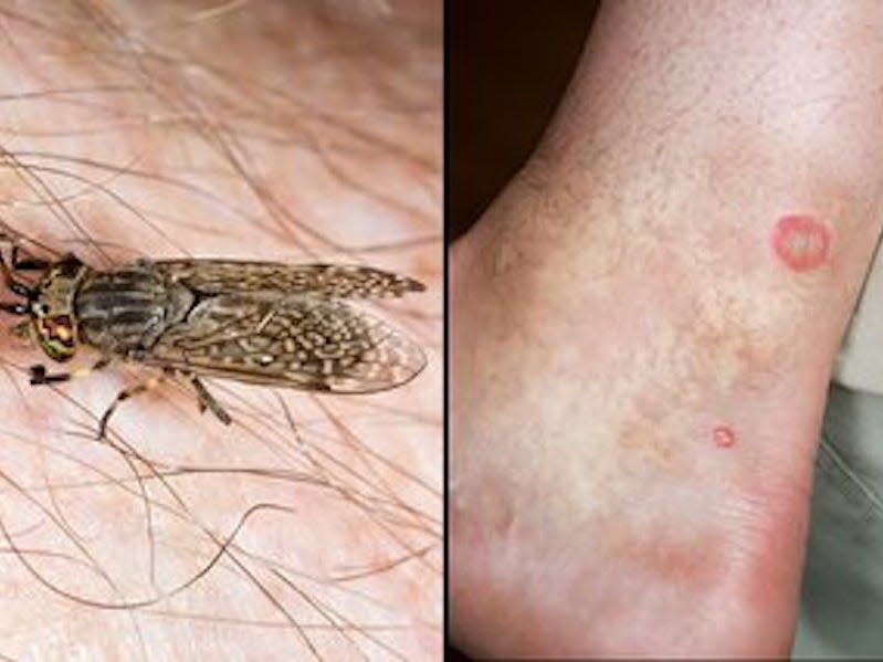 horse fly bite