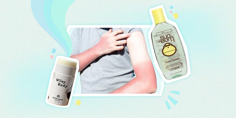 10 Expert-Approved Products to Revive Sunburned Skin