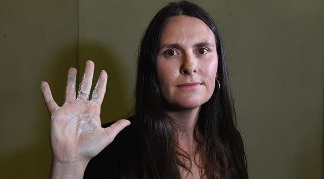 Pro-refugee activist Sally (last name not given) holds her hand up, which was super-glued during a protest in the House of Representatives. Source: AAP