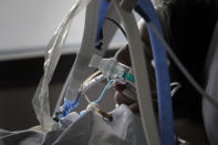 A patient affected by the COVID-19 virus in the ICU unit at the Charles Nicolle public hospital, Thursday, April 15, 2021 in Rouen, France. A renewed crush of COVID-19 cases is again forcing intensive care units across France to grapple with the macabre mathematics of how to make space for thousands of critically ill patients (AP Photo/Christophe Ena)