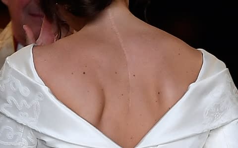 Before the wedding Princess Eugenie said it was important for people to show their scars  - Credit: Toby Melville AFP