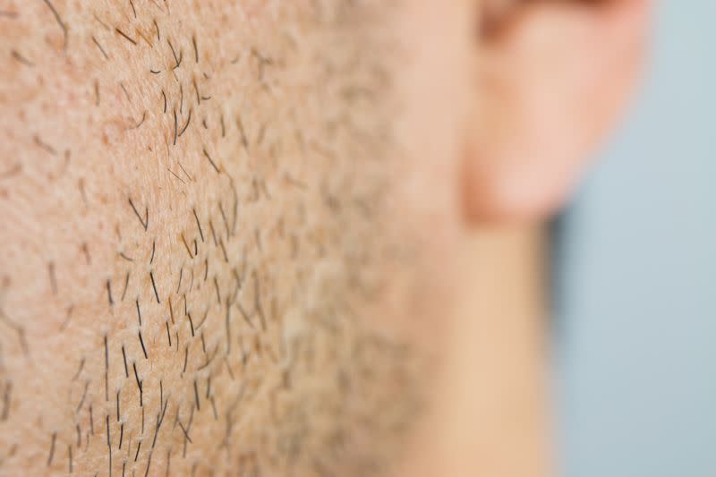 Certains hommes ne parviennent pas à avoir de barbe, malgré tous leurs efforts [Photo: Getty]