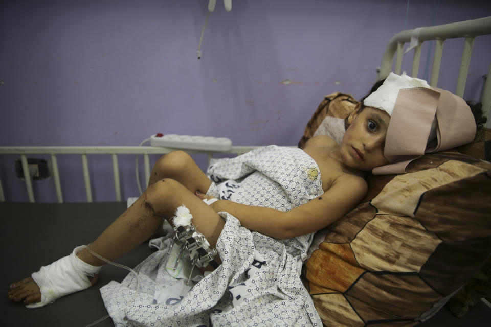 Kenzi al Madhoun, a four-year-old who was wounded in Israeli bombardment lies at Al Aqsa Hospital in Deir al Balah City, Gaza Strip, Wednesday, Nov. 1, 2023. (AP Photo/Abdel Kareem Hana)