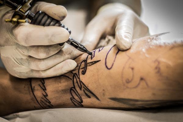 Discover more than 127 acoustic tattoo removal best