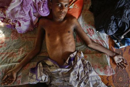 Akram, an 18-year-old Rohingya, who cannot walk and whose body is pocked with fly-blown sores from months of immobility, rests on a makeshift bed at a mosque near Songkhla, close to Thailand's border with Malaysia, in this February 12, 2014 file photo. REUTERS/Damir Sagolj