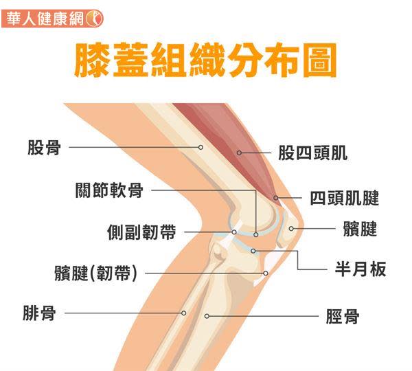 膝蓋卡卡好不了 當心半月板受損 把握黃金治療期