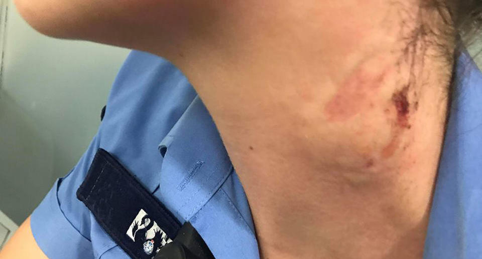 The officer was taken for a blood test after suffering a wound in the incident. Source: Facebook/ WA Police Union