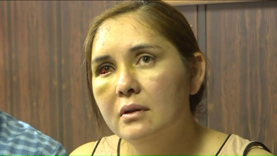 Beronica Ruiz says she was beaten unconscious by a 13-year-old boy who had been bullying her son at school, telling him to go back to Mexico. (Photo: Pix 11)