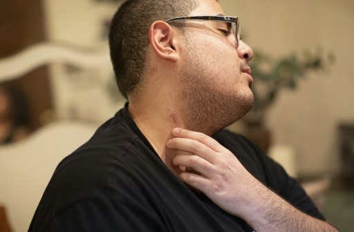 Gregory Rodriguez nearly died from vaping THC; he show scars on his neck from where tubes to oxygenate his blood were inserted
