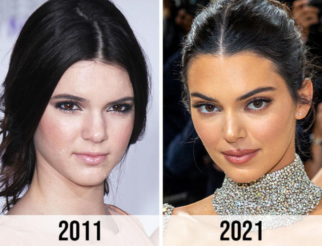 Kendall Jenner Before And After Plastic Surgery Journey T News