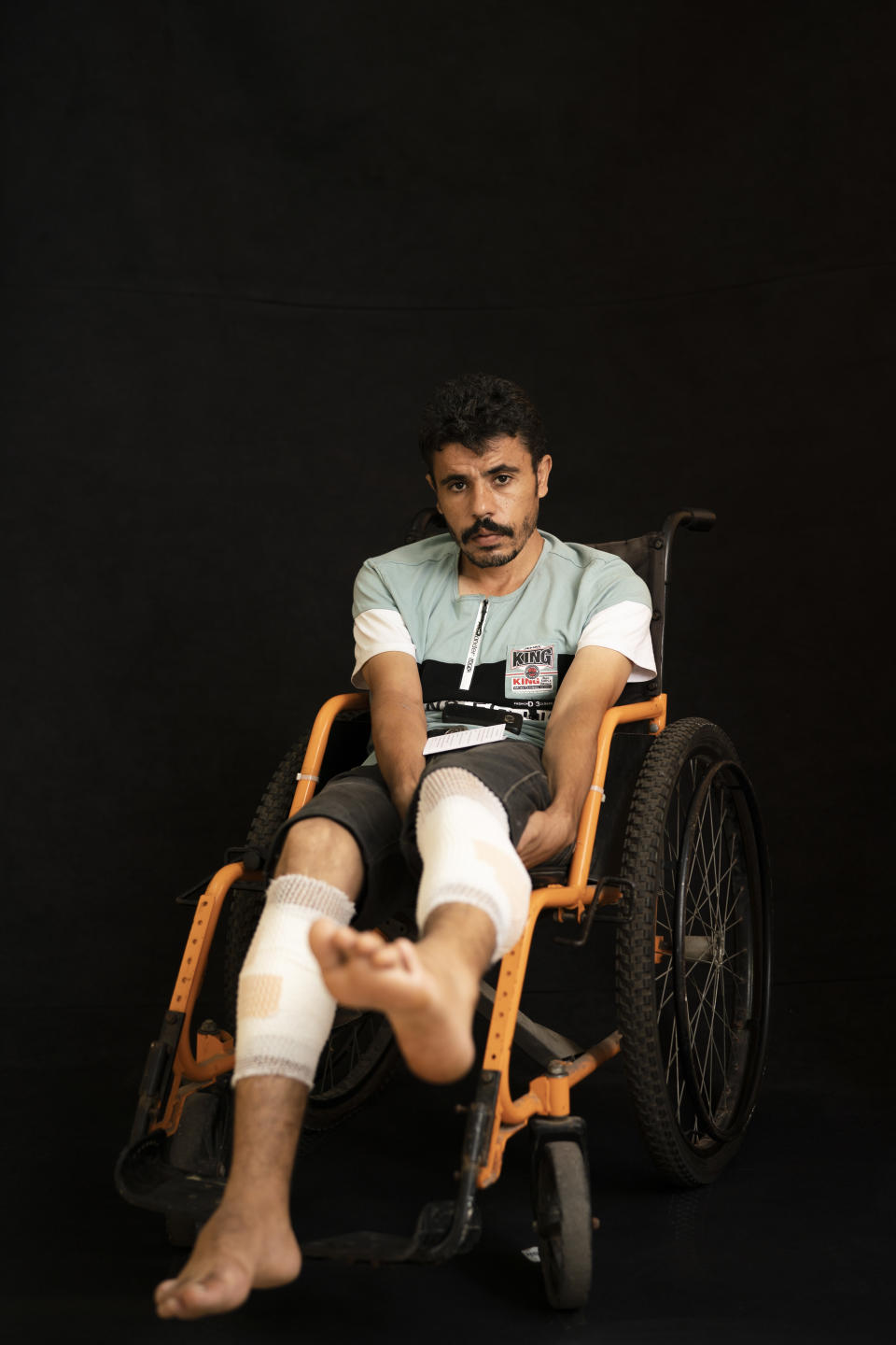 In this Sept. 19, 2018, photo, Ayman Harb, 36, poses as he awaits treatment at a Gaza City clinic run by MSF (Doctors Without Borders). Harb, a paramedic was injured several times. In the last protest, he was shot while trying to help someone get out of the out of the Mediterranean. (AP Photo/Felipe Dana)