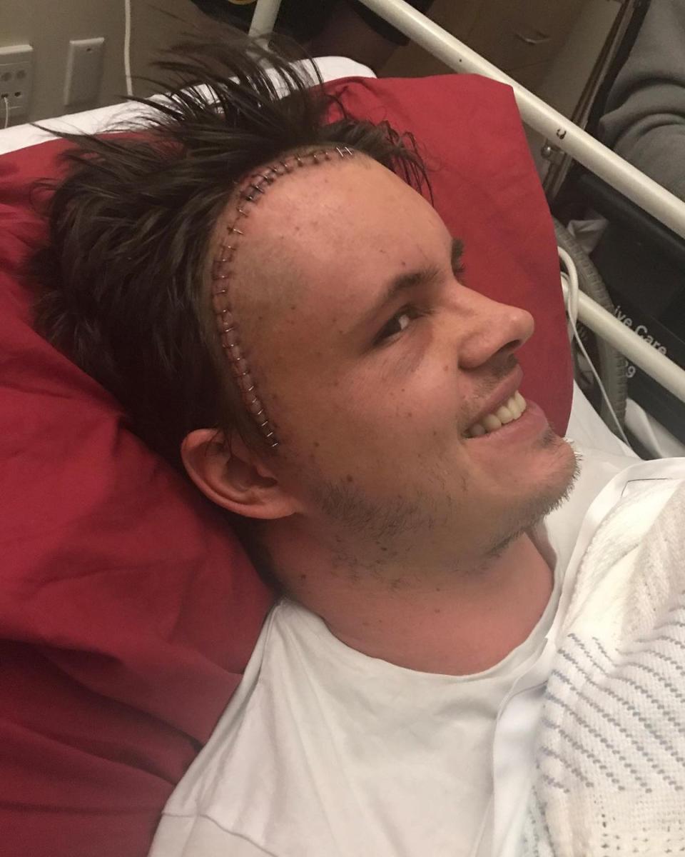 home and away star Johnny ruffo diagnosed with brain cancer in 2017