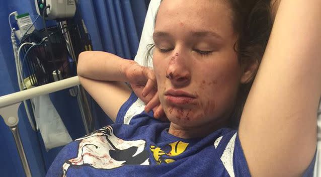 Ashlee Savins' roommate took her to hospital after the alleged attack. Photo: Facebook