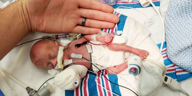 What is a Micro Preemie and What Should You Know?