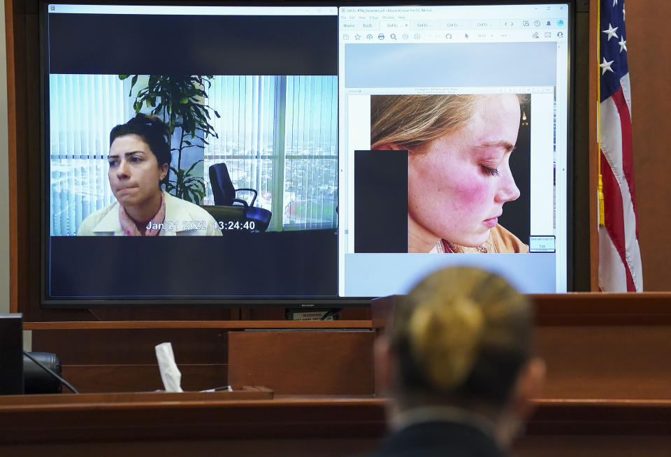 Actor Johnny Depp listens as Raquel Pennington testifies in a previously recorded video deposition, as a picture of Amber Heard is seen on screen, in the courtroom at the Fairfax County Circuit Courthouse in Fairfax, Va., Wednesday, May 18, 2022. Actor Johnny Depp sued his ex-wife Amber Heard for libel in Fairfax County Circuit Court after she wrote an op-ed piece in The Washington Post in 2018 referring to herself as a "public figure representing domestic abuse." (Kevin Lamarque/Pool Photo via AP)