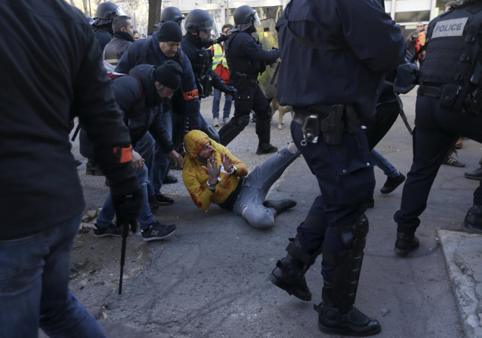 French plainclothes police drag a bleeding, handcuffed protestor, during a yellow vest demonstration in Marseille, France, Saturday, Jan. 12, 2019. Paris brought in armored vehicles and the central French city of Bourges shuttered shops to brace for new yellow vest protests. The movement is seeking new arenas and new momentum for its weekly demonstrations. Authorities deployed 80,000 security forces nationwide for a ninth straight weekend of anti-government protests. (AP Photo/Claude Paris)