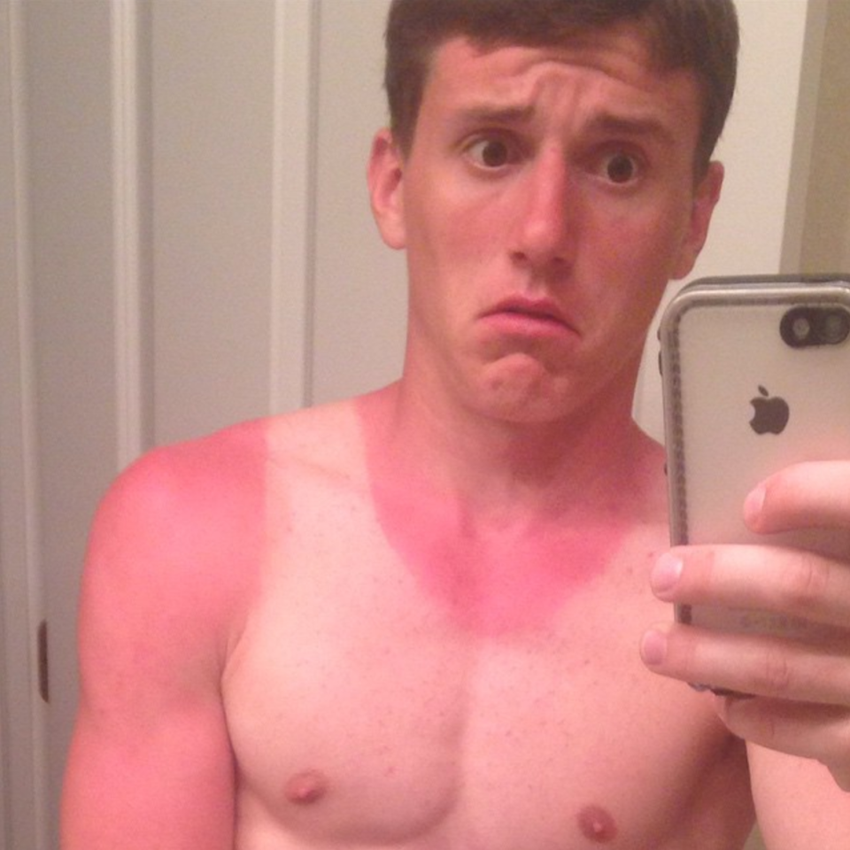 The classic vest burn