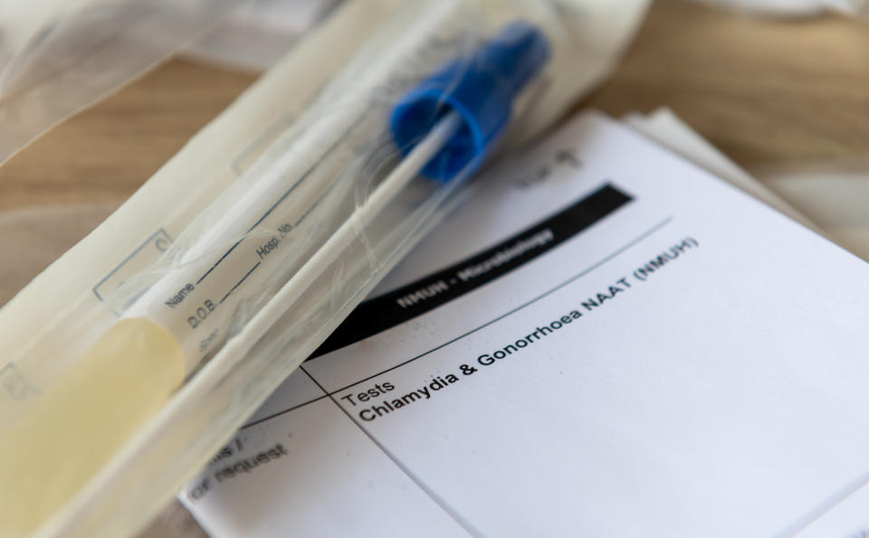 A close-up of a medical document labeled "Test: Chlamydia & Gonorrhoea NAAT (NMUC)" with swabs placed alongside the paperwork