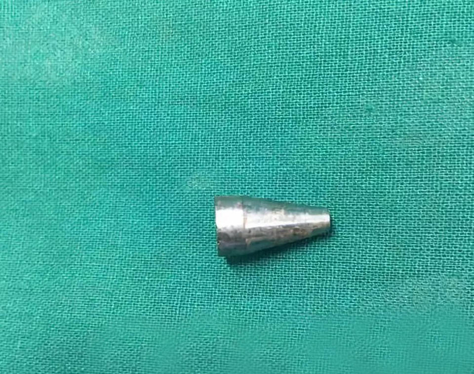 The tip of a pen was removed from the schoolgirl. Source: Australscope/AsiaWire