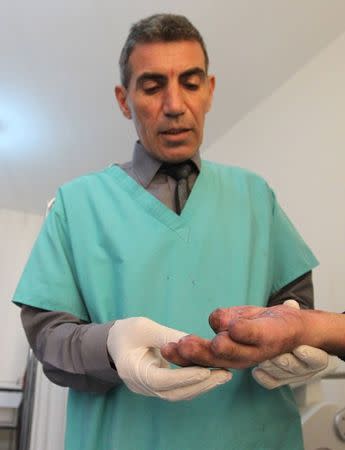 Palestinian plastic surgeon Salah El-Zanin shows the hand of a man who suffered a disfiguring injury, at his clinic in Gaza City March 2, 2015. REUTERS/Ahmed Zakot