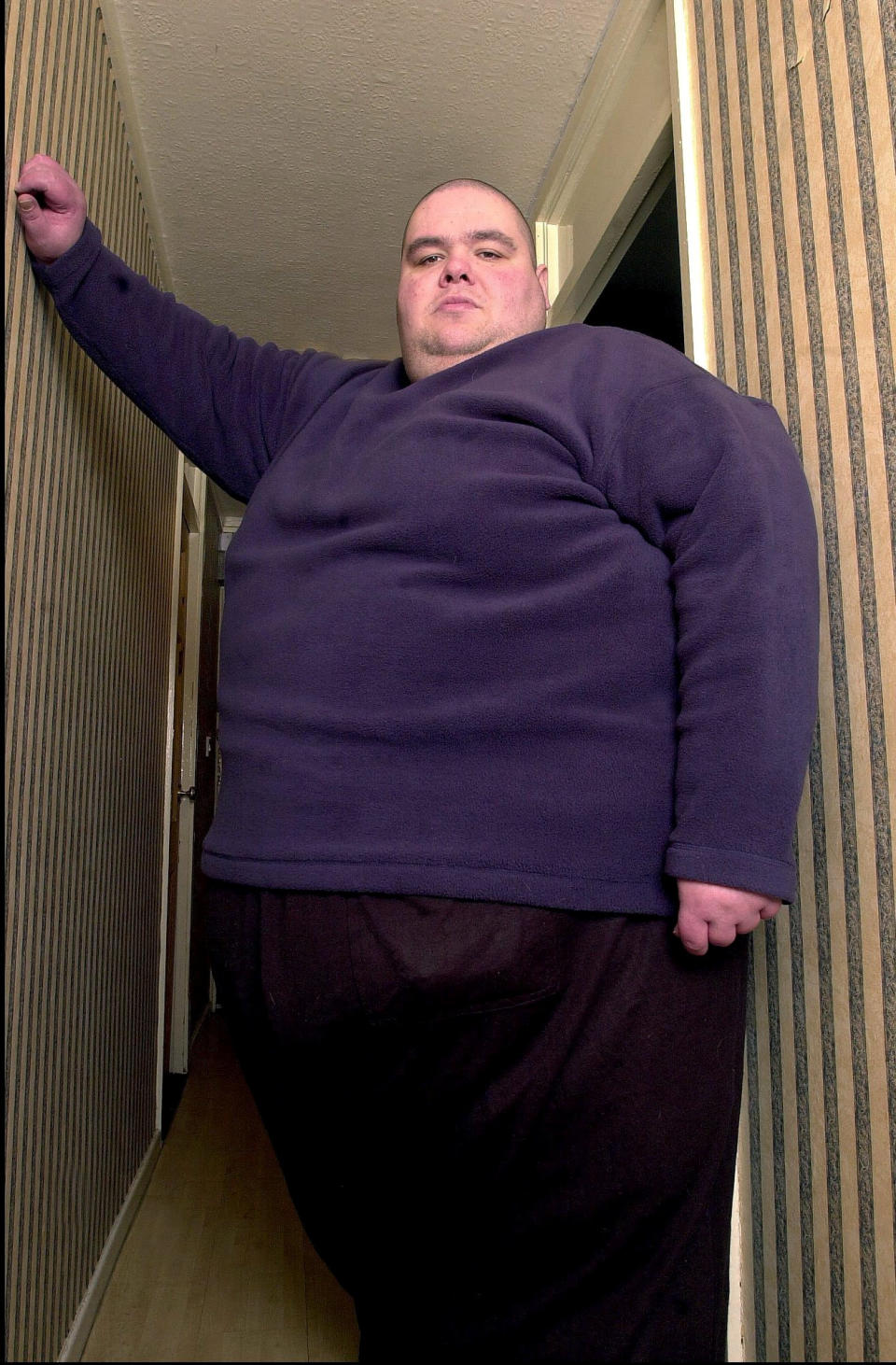 Once known as Britain's fattest man his weight peaked at 65 stone.At one point he consumed up to 29,000 calories and drinking up to 12 litres of fizzy drink in a day. (SWNS)