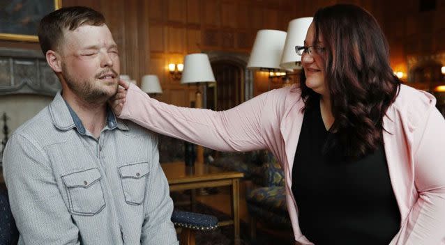 A widow has had an emotional meeting with the man who was given her late husband’s face. Photo: Associated Press