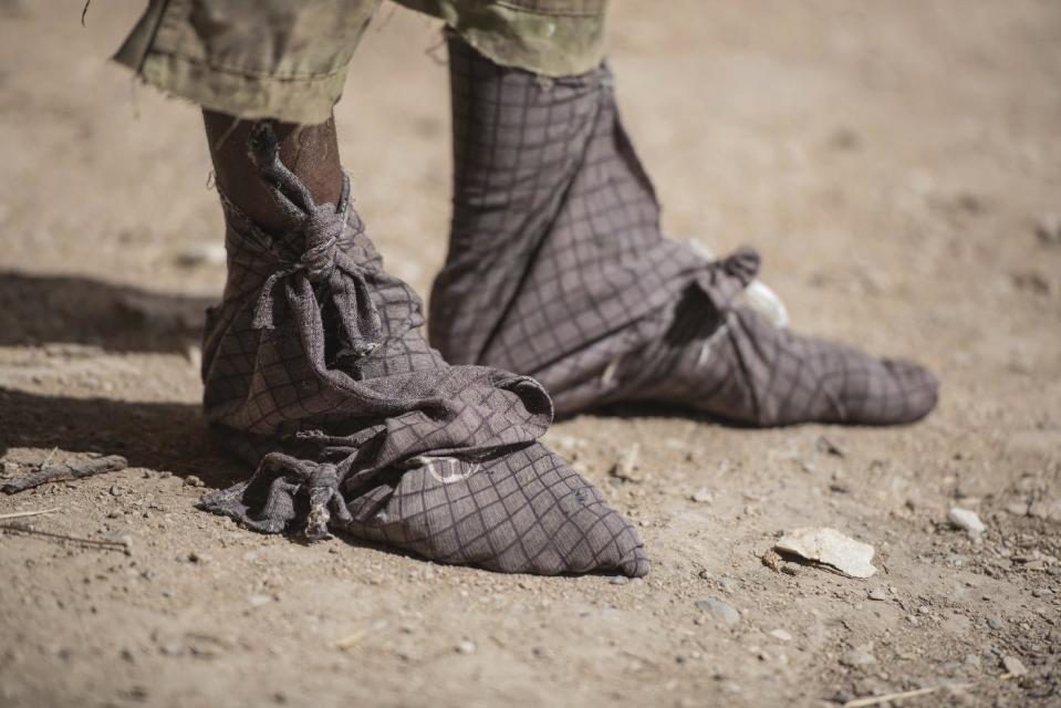 In this Tuesday, Aug. 2, 2016 photo, a frankinsence tapper wears cloth wrapped on his feet to keep sticky resin from his skin and shoes near Gudmo, Somaliland, a breakaway region of Somalia. These last intact wild frankincense forests on Earth are under threat as prices have shot up in recent years with the global appetite for essential oils, and overharvesting has led to the trees dying off faster than they can replenish, putting the ancient resin trade at risk. (AP Photo/Jason Patinkin)