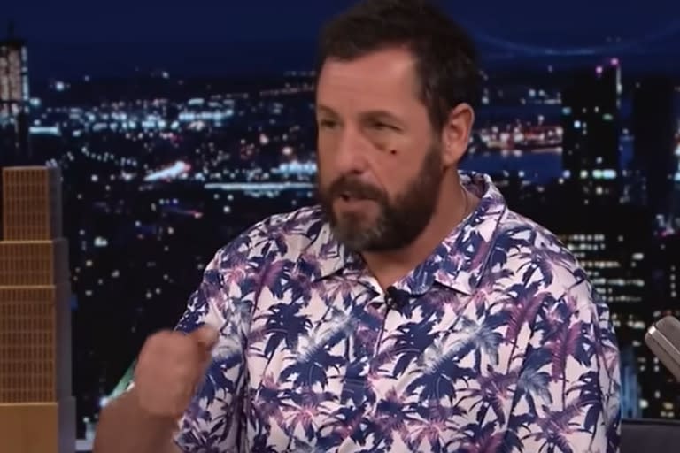 Adam Sandler apareció con un ojo morado en un programa de televisión y explicó el insólito motivo