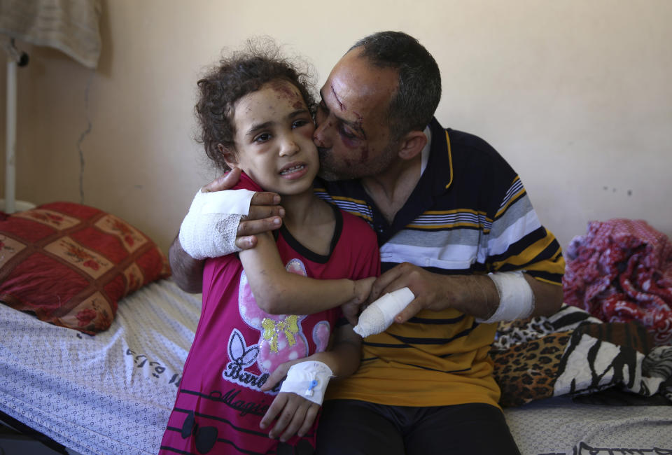 Suzy Ishkontana, 7, is kissed by her father Riad Ishkontana, 42, at Shifa Hospital in Gaza City, Tuesday, May 18, 2021. Suzy and her father Riad were the only survivors of their family after an Israeli airstrike destroyed one of the buildings they lived in in Gaza City early Sunday, killing her mother and four siblings. The man and his daughter were pulled alive from under the rubble after several hours. (AP Photo/Abdel Kareem Hana)