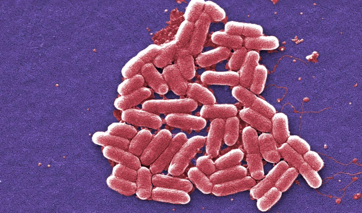 Two children from the same family have died from the E.coli bacteria (PA)
