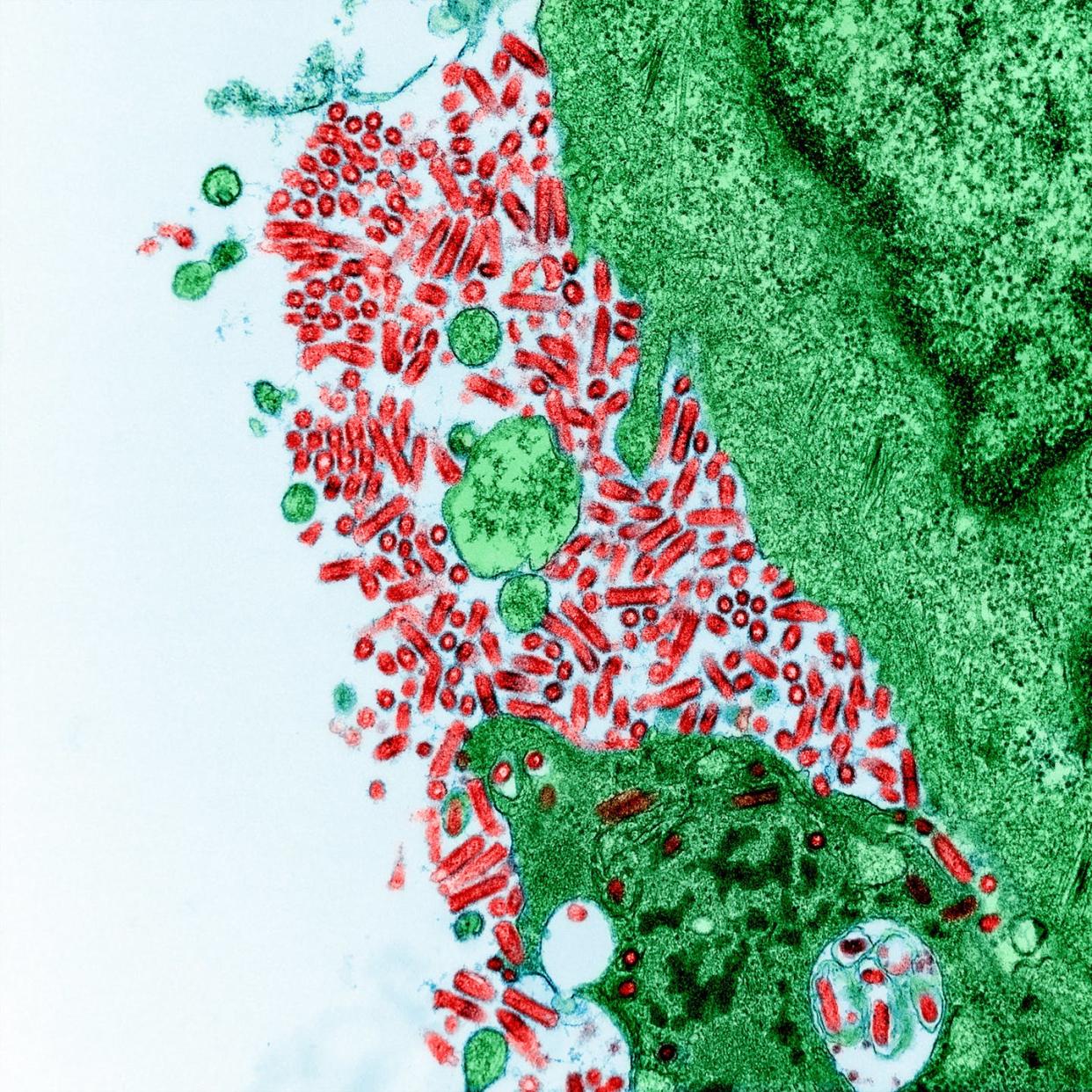 Rabies virus (red) has an incubation period that can last from days to months. <a href="https://flic.kr/p/2mM8QjD" rel="nofollow noopener" target="_blank" data-ylk="slk:NIAID/Flickr;elm:context_link;itc:0;sec:content-canvas" class="link ">NIAID/Flickr</a>, <a href="http://creativecommons.org/licenses/by/4.0/" rel="nofollow noopener" target="_blank" data-ylk="slk:CC BY;elm:context_link;itc:0;sec:content-canvas" class="link ">CC BY</a>