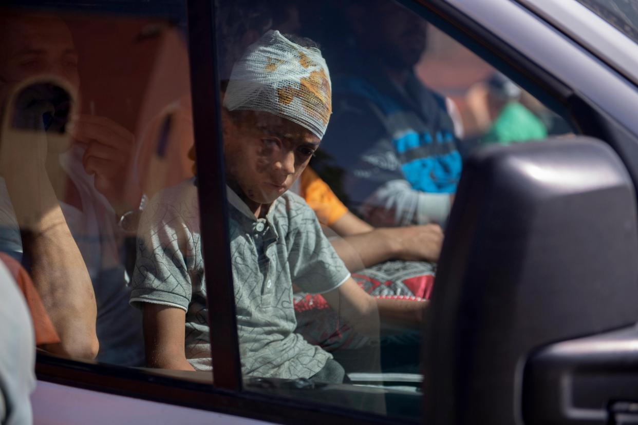 An injured child is transported from the health center of Amizmiz to Marrakech (EPA)