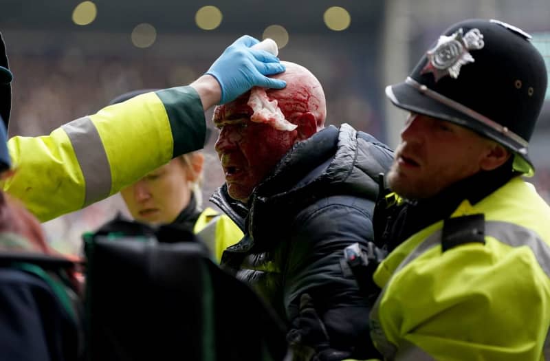 Police officers remove a fan who received a cut to his head during clashes in the stands during the English FA Cup fourth round soccer match West Bromwich Albion and Wolverhampton Wanderers at The Hawthorns. Bradley Collyer/PA Wire/dpa