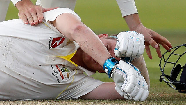 Seen here, a concussed Steve Smith in the 2019 Ashes series. 