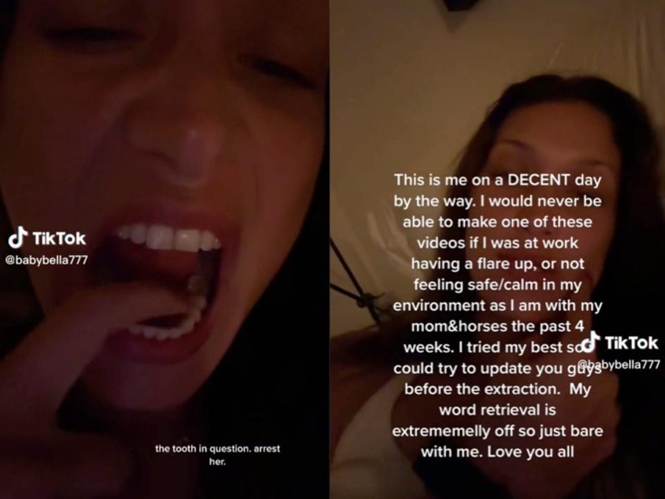 The model gave fans a brief history of her struggle with Lyme disease over the years (TikTok/Bella Hadid)