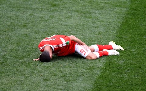  Alan Dzagoev of Russia holds his leg as he goes down injured during the 2018 FIFA World Cup Russia Group A match between Russia and Saudi Arabia at Luzhniki Stadium - Credit: Shaun Botterill/Getty Images