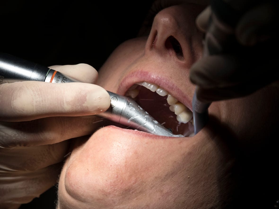 The federal budget tabled in the House of Commons on Thursday earmarks $5.3 billion over five years and an annual cost of $1.7 billion for dental care across the country after the program is fully implemented in 2025. P.E.I. launched its own dental care program last year. (Sebastien Bozon/AFP/Getty Images - image credit)