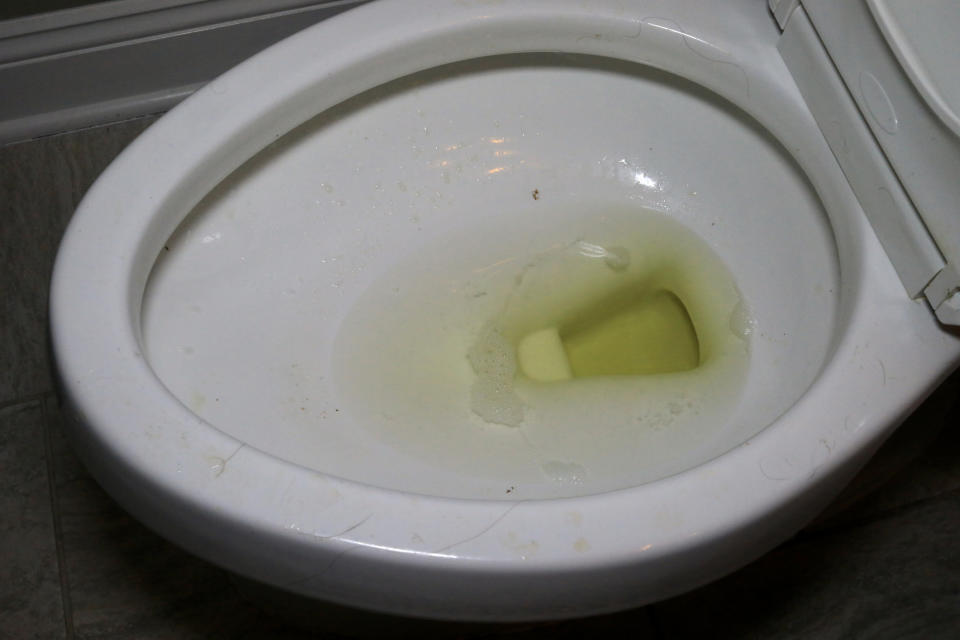 toilet bowl