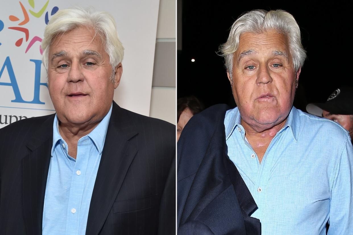 Jay Leno attends "May Contain Nuts! A Night Of Comedy" Benefiting WeSPARK Cancer Support Center; Jay Leno arriving in good spirits for his first stand-up show after his burn accident at the Comedy & Magic Club in Hermosa Beach