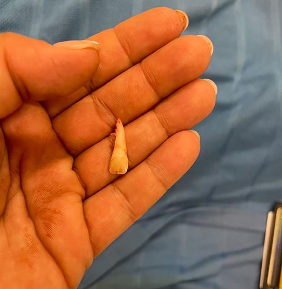 Child's tooth in mum's hand