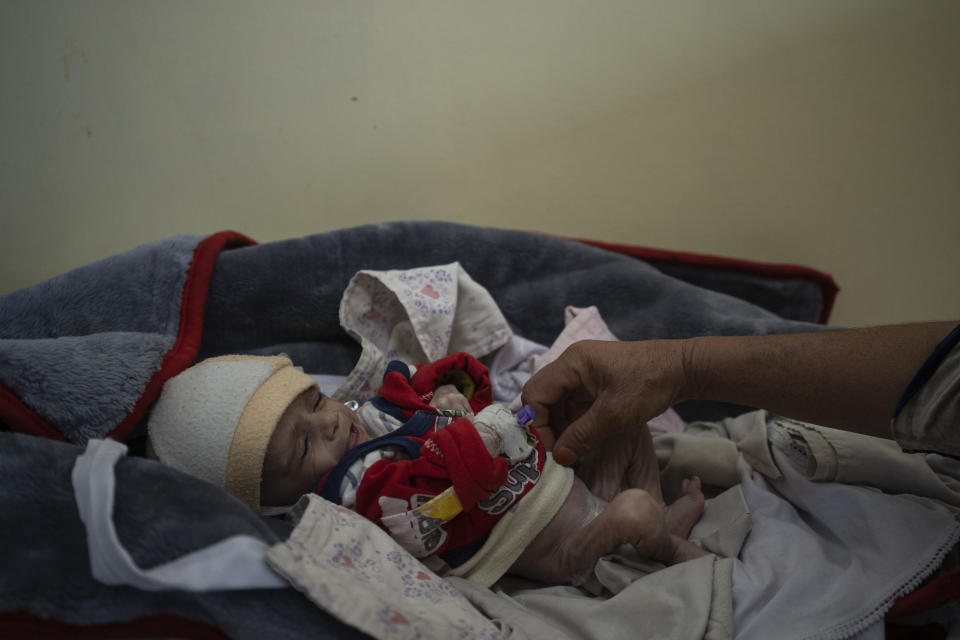 Four-month-old Mohammed who is malnourished lays on a hospital bed in the Indira Gandhi hospital in Kabul, Afghanistan, Monday, Nov. 8, 2021. The number of people living in Afghanistan in near-famine conditions has risen to 8.7 million according to the World Food Program. (AP Photo/Bram Janssen)