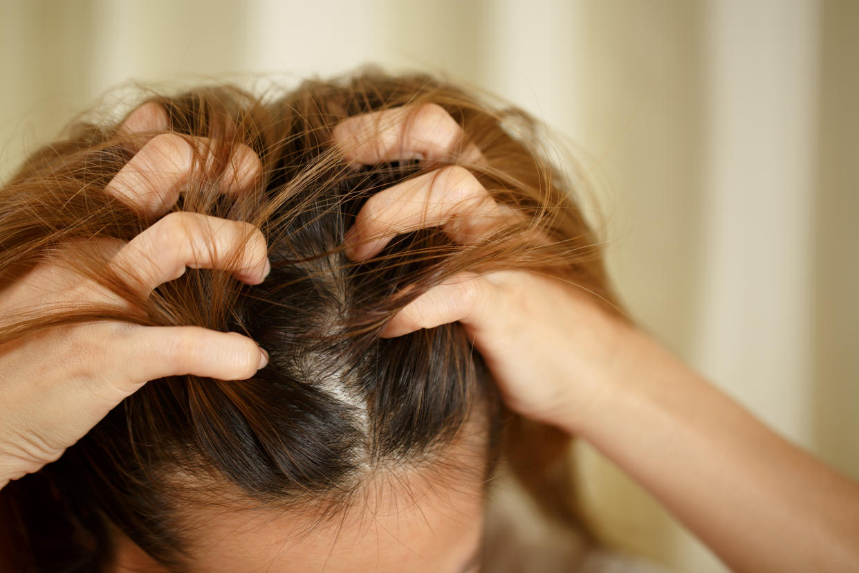 Seasonal hair loss more commonly occurs during the autumn months. (Getty Images)