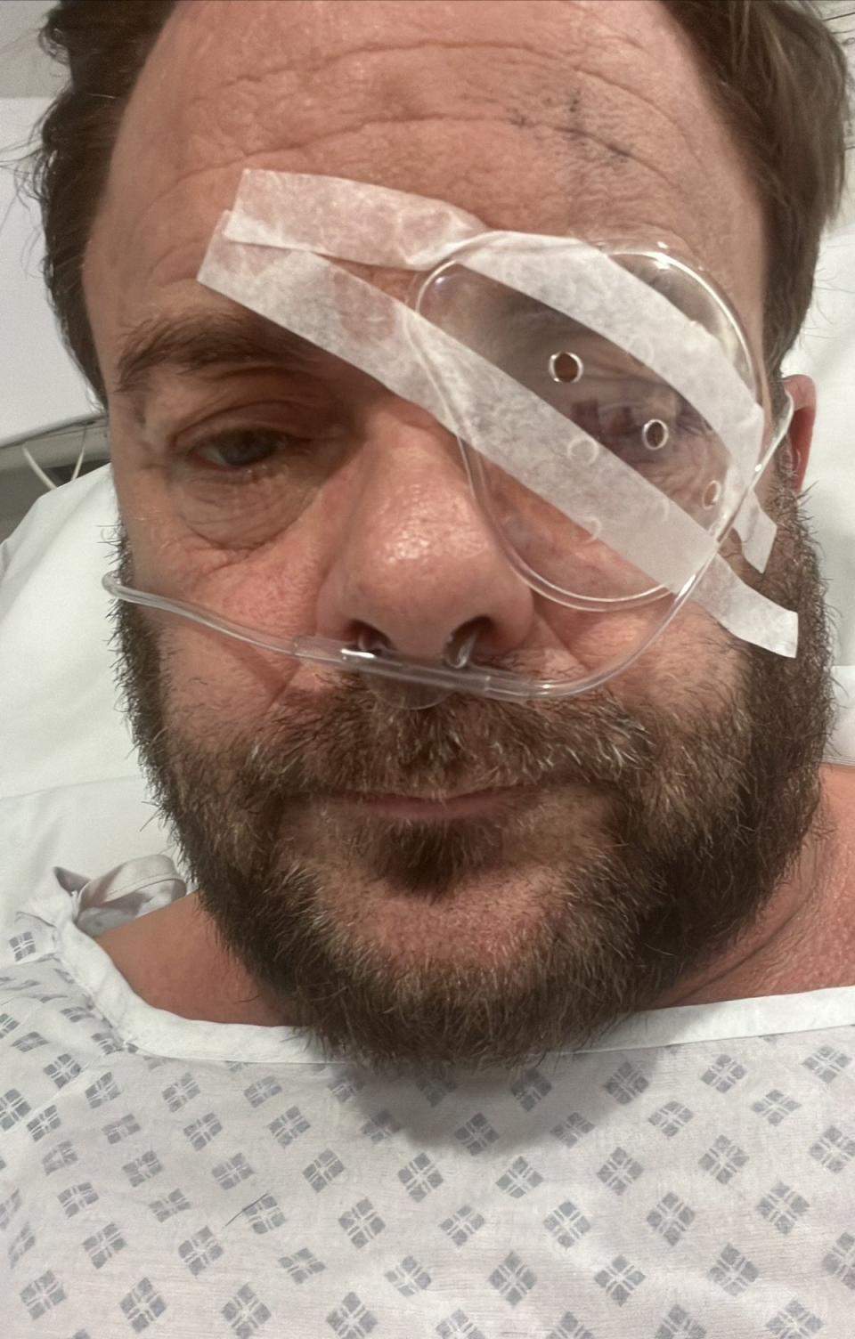 Spencer had his left eye “bolted” after the attack in Surbiton (Specner Gymer)