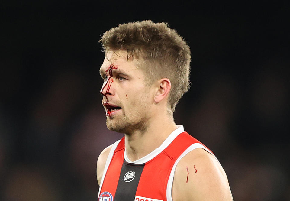 Dan Butler, pictured here after his head clash with St Kilda teammate Hunter Clark.