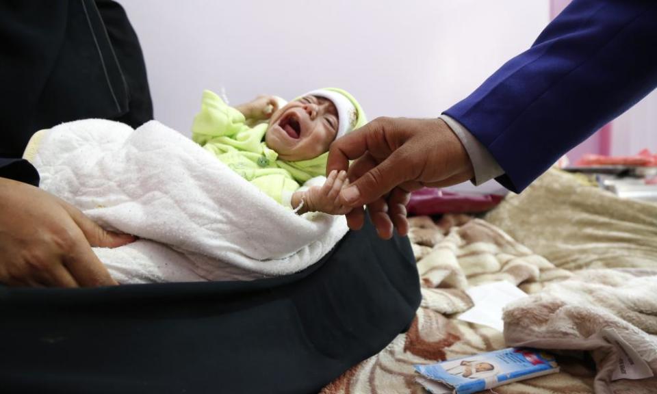 A doctor holds the hand of a malnourished child at a care centre in Sanaa, Yemen, 16 October