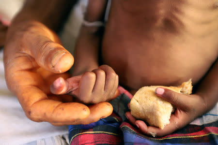 Hanaa Ahmad Ali Bahr, a malnourished girl holds a piece of bread in a shanty town in Hodeidah, Yemen March 25, 2019. REUTERS/Abduljabbar Zeyad