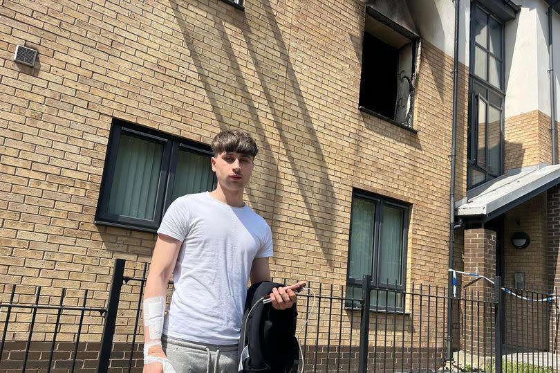 Eryk Czerewaty outside his family's flat, with his burns bandaged, below the window of his family's first-floor flat which went up in flames