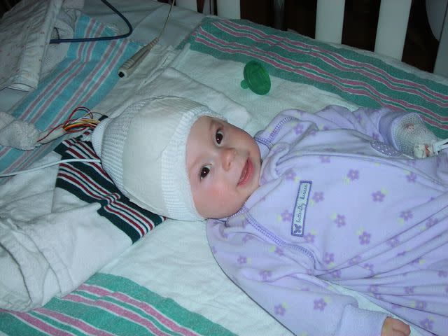 <p>Courtesy Leeb Family</p> Mora Leeb in March 2008 at six months old with brain monitoring equipment.