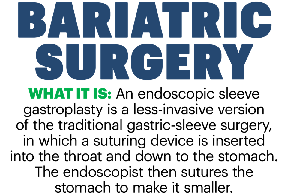 bariatric surgery what it is an endoscopic sleeve gastroplasty is a less invasive version of the traditional gastric sleeve surgery in which a suturing device is inserted into the throat and down to the stomach the endoscopist then sutures the stomach to make it smaller